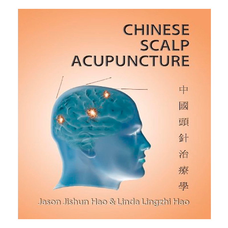 Chinese Scalp Acupuncture